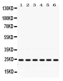 WB - Anti-Rab5 Picoband Antibody ABO12473